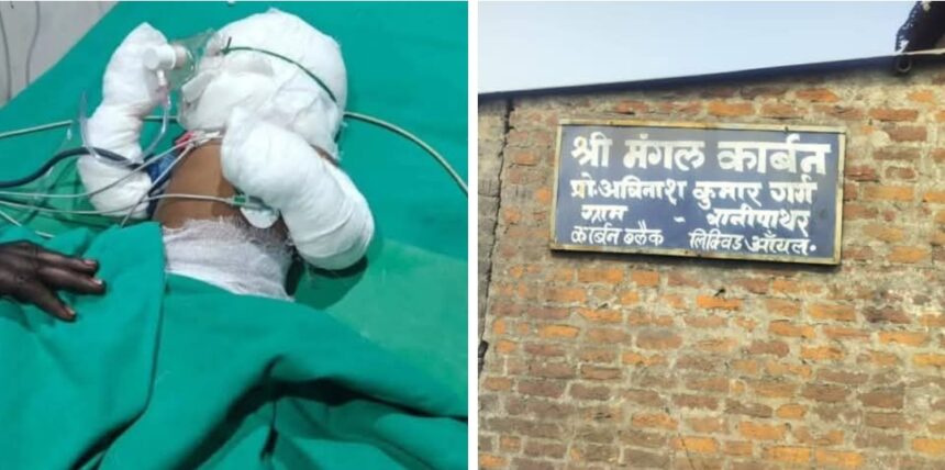 मंगल कार्बन प्लांट हादसा: हादसे में झुलसी नौ माह की मासूम की मौत 