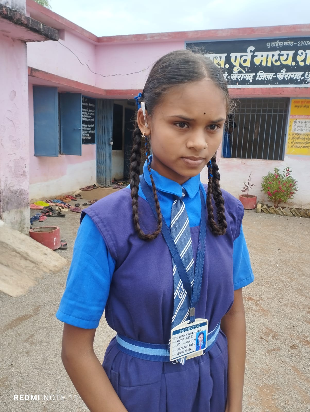 चिरायु योजना से 14 साल की छात्रा रागिनी पटेल की जन्मजात बधिरता से मिली मुक्ति