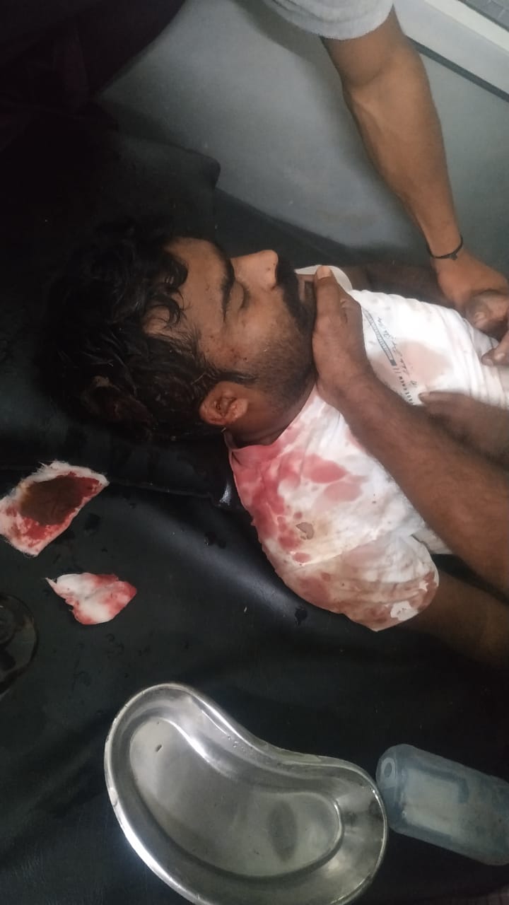 भीम आर्मी छत्तीसगढ़ के प्रदेश अध्यक्ष राजकुमार जांगड़े हुए दुर्घटना का शिकार