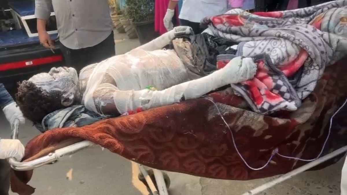 रायगढ़ के टायर प्लांट में बड़ा हादसा,9 महीने की मासूम समेत 8 मजदूर गंभीर रूप से झुलसे