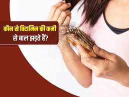 क्या आप के भी तेजी से झड़ रहे हैं बाल तो इन विटामिन की हो सकती ...