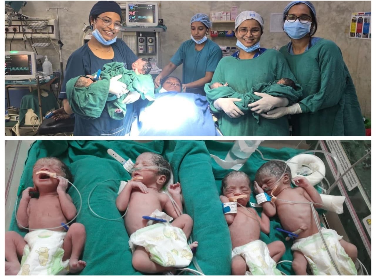 जिला मेडिकल कॉलेज महासमुंद में रचा गया चिकित्सा इतिहास,एक साथ चार बच्चियों का सफल जन्म