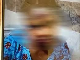 चरित्र संदेह को लेकर विवाद,पति ने पत्नी को आग में झोंका, हालत नाजुक