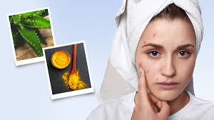 सोने से पहले ऐसे चेहरे पर लगाएं एलोवेरा-हल्दी मास्क, पाएं कील-मुहांसों से छुटकारा
