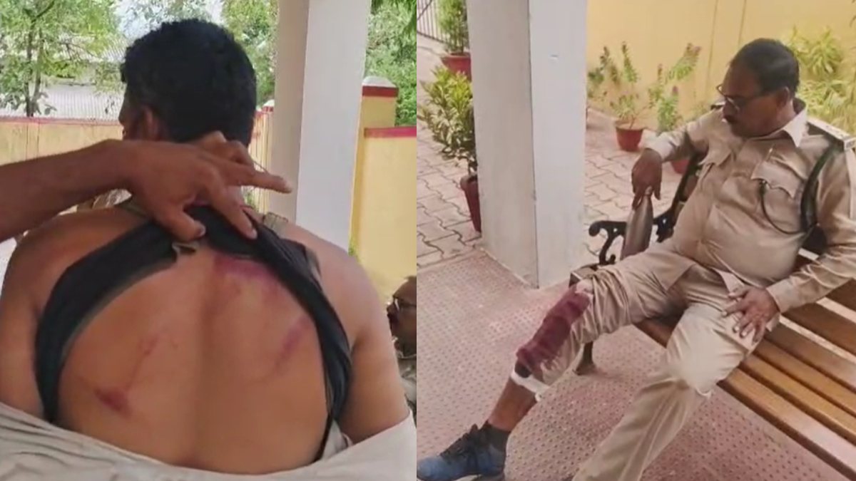 वन विभाग की टीम पर हमला: डिप्टी रेंजर सहित कई वन्यकर्मी घायल