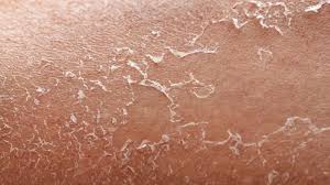 बदलते मौसम में झुर्रियों वाली स्किन से हैं परेशान? तो अपनाएं ये असरदार घरेलू नुस्खे