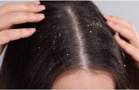 नहाते समय भूलकर भी न करें ये गलतियां,सर्दियों में बढ़ जाएगी डैंड्रफ की परेशानी