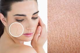 अपनाएं इन असरदार घरेलू उपाय को और पाएं सर्दियों में रूखी और खुजली वाली स्किन से राहत