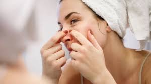 पिंपल्स फोड़ने की आदत बिगाड़ सकती है चेहरा, इन्फेक्शन और स्कारिंग का रहता है खतरा