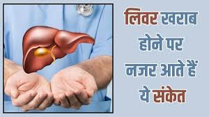 पैरों में नजर आते हैं लिवर डैमेज के लक्षण,ना करें अनदेखा पड़ सकता है भारी  
