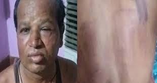 मंत्री के भतीजे का कारनामा: पेट्रोल पंप के सुपरवाइजर के साथ की मारपीट, कांग्रेस का आरोप पुलिस ने दर्ज नहीं किया लूट का मामला
