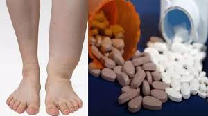 फाइलेरिया के लिए सामुहिक दवा सेवन अभियान 10 फरवरी से