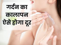 गर्दन का कालापन ऐसे होगा दूर,अपनाएं ये सरल घरेलू उपाय
