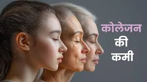 कोलेजन की कमी होने पर नजर आते हैं ये लक्षण,सेहत और त्वचा पर पड़ सकता है बुरा असर 