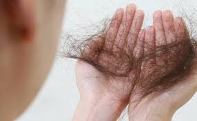 तेजी से झड़ रहें हैं बाल तो आज ही अपनी डाइट से हटाएं ये चीजें 