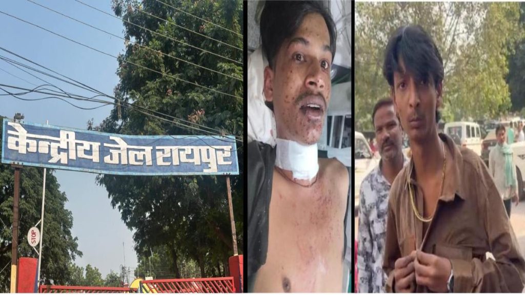 सेन्ट्रल जेल के बाहर चली गोली, एक युवक गंभीर, मौके पर पहुंची पुलिस …