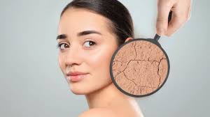 Skin Dryness: सर्दी के मौसम में भूलकर भी न करें ये गलतियां, वरना स्किन हो जाएगी और ज्यादा ड्राई