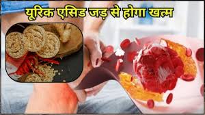 यूरिक एसिड को जड़ से ख़त्म करेगा ये चीज,बस करें ये काम 