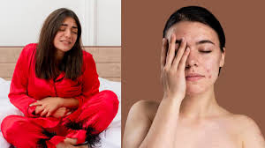 पीरियड्स के दौरान हर महीने क्यों बिगड़ जाती है स्किन? जानें  एक्सपर्ट से