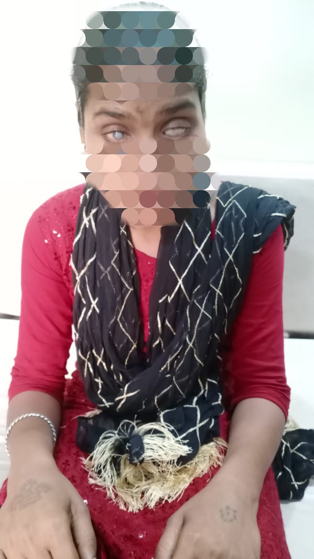 प्रयास कलेक्टर की रंग लाई, ममता के आंखों की रोशनी लौटी