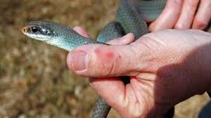 अजब MP में गजब का घोटाला,सांप काटने के नाम पर हो गया घोटाला 