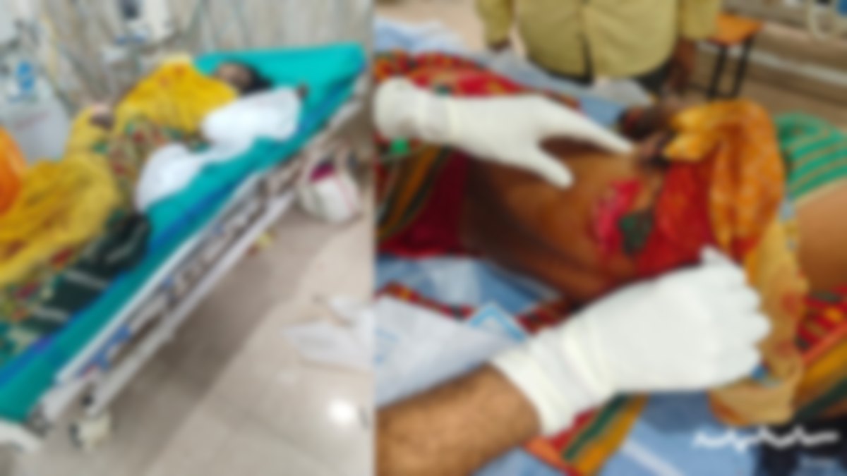 डोंगरगढ़ के जंगल में दहशत: जंगली सूअर का हमला, 5 महिलाएं गंभीर घायल