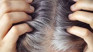 कम उम्र में सफेद बालों की समस्या,अपनाएं ये घरेलू उपाय