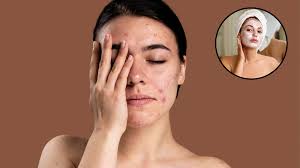 स्किन केयर: चेहरे पर भूलकर भी न लगाएं ये चीजें 