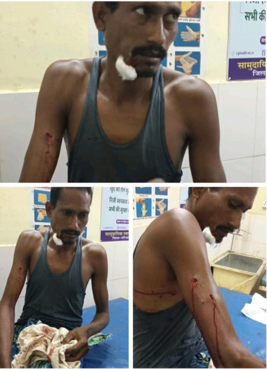 खेत में काम कर रहे ग्रामीण पर तेंदुए का हमला, सूझबूझ से बची जान — पाण्डुका वन क्षेत्र में दहशत, वन विभाग की कार्यप्रणाली पर सवाल